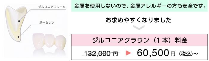 ジルコニアクラウン料金